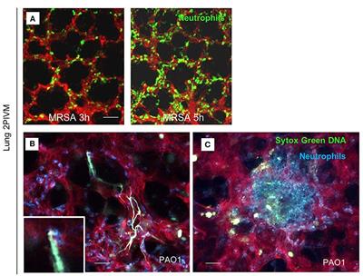 Intravital Imaging of Pulmonary Immune Response in Inflammation and Infection